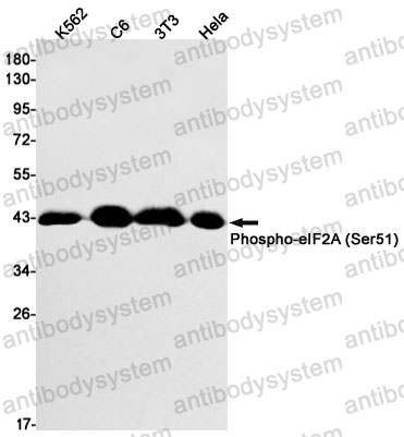 Anti-Phospho-EIF2S1/eIF2A (Ser51) Antibody (R1K19)