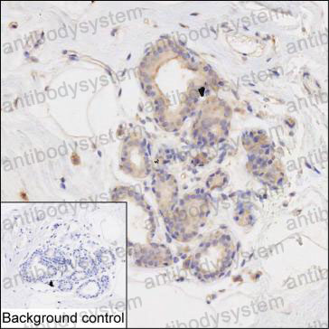 Immunohistochemical for Anti-EIF2S1 Antibody (R2Z14) ?>