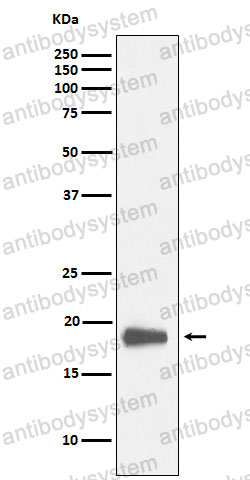 Anti-HMGN2 Antibody (R1K20)