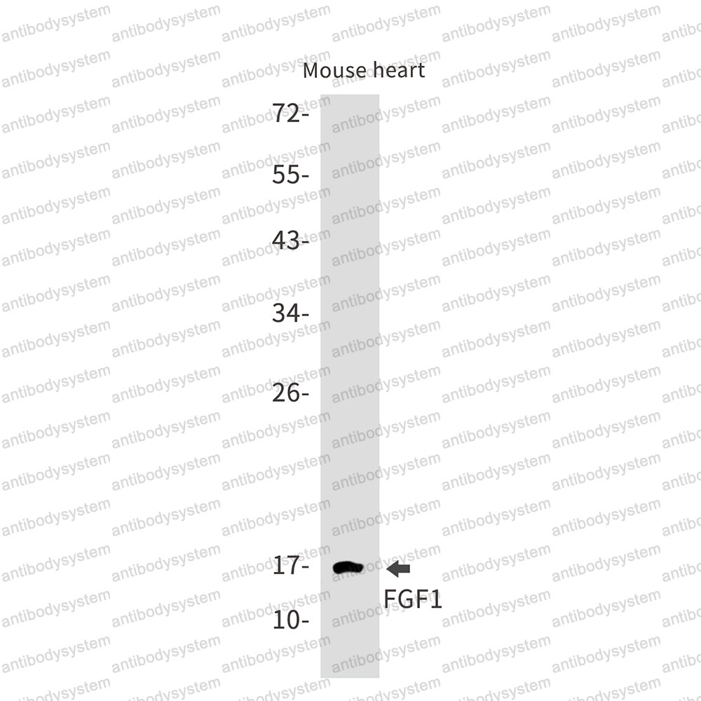 Anti-FGF1/aFGF Antibody (R1K22)