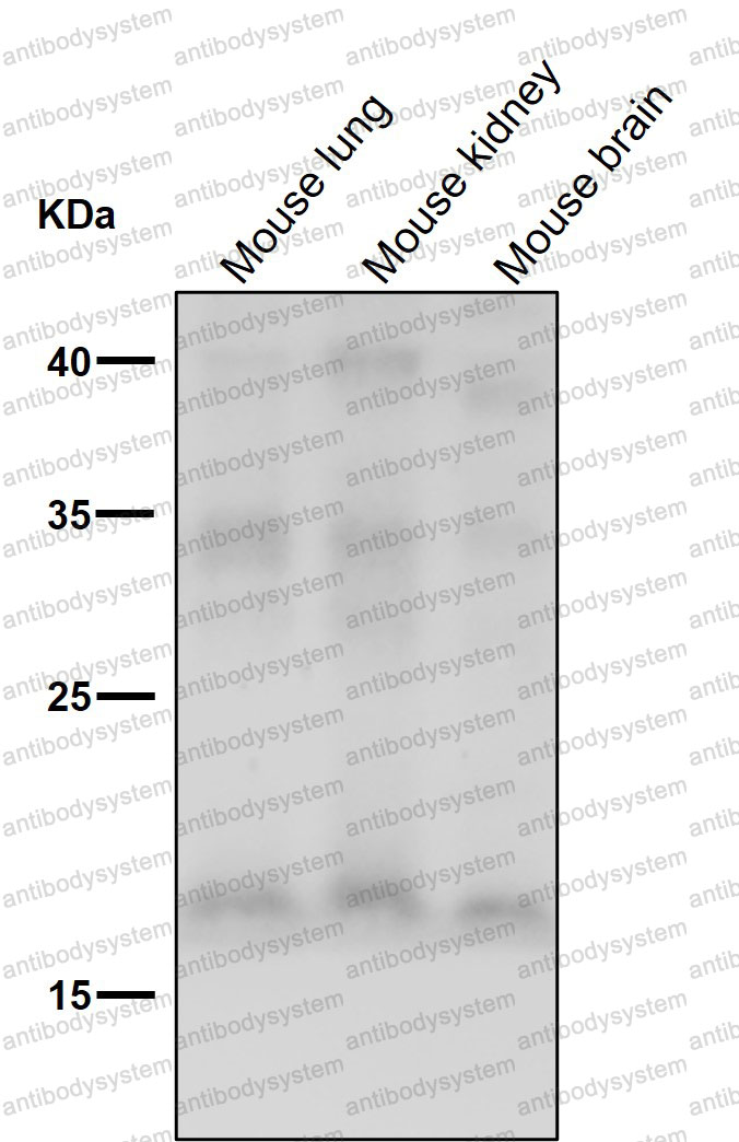 Anti-FGF1/aFGF Antibody (R1K21)