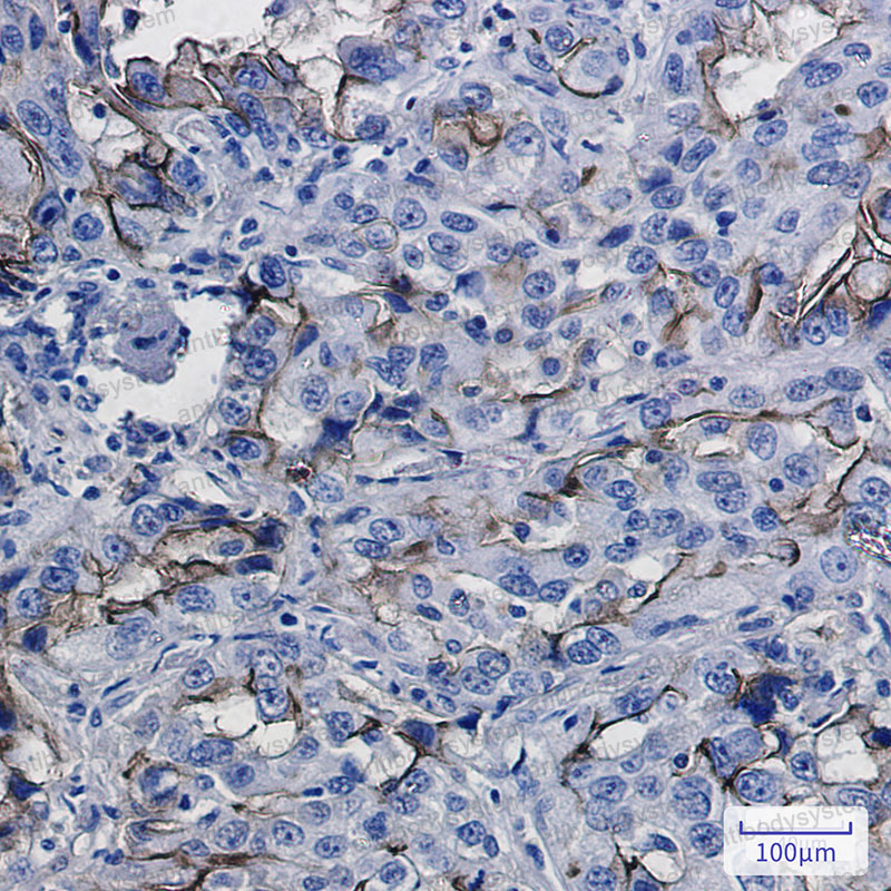 Anti-CD54/ICAM1 Antibody (R1K24)