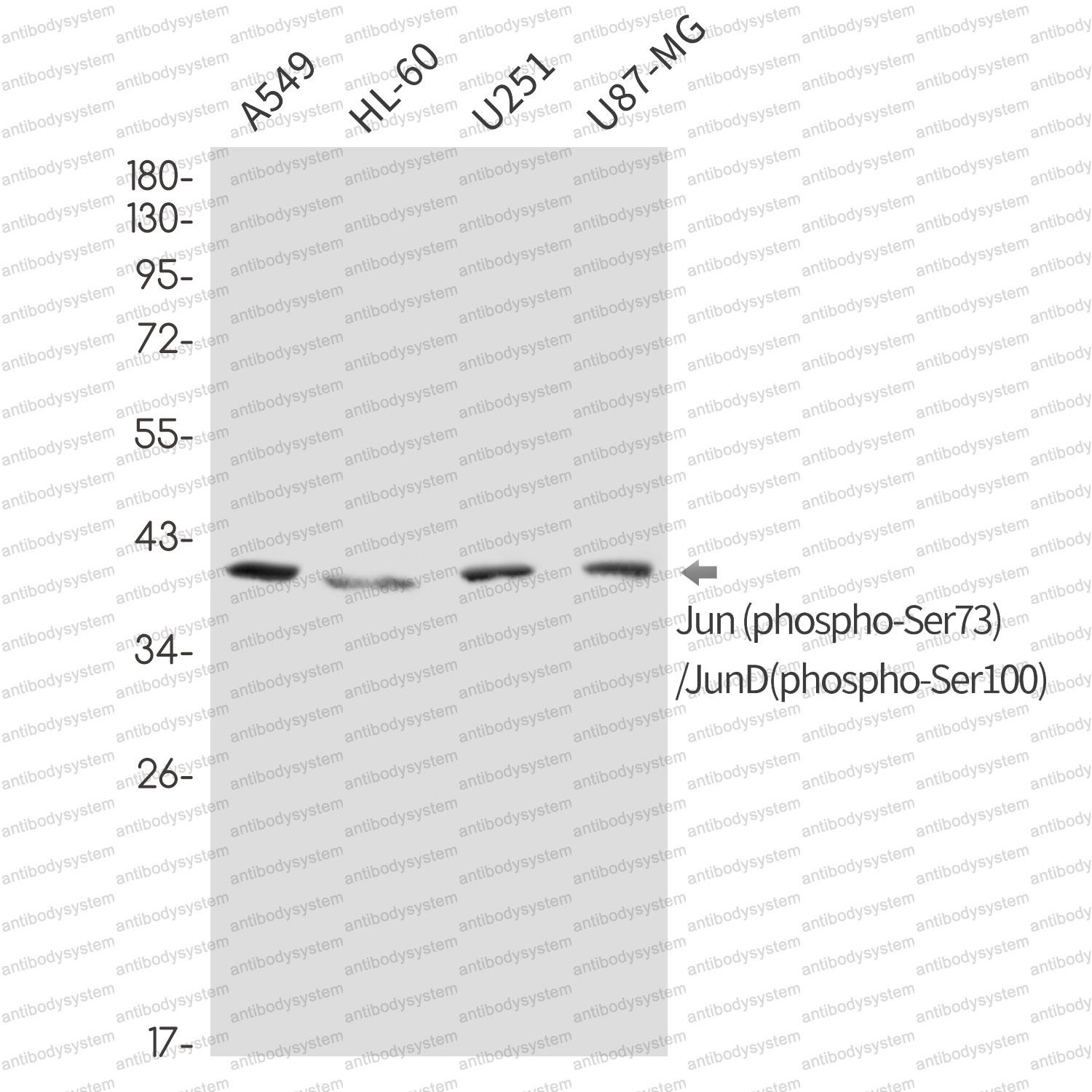 Anti-Phospho-Jun/JunD (Ser73/Ser100) Antibody (R1K27)