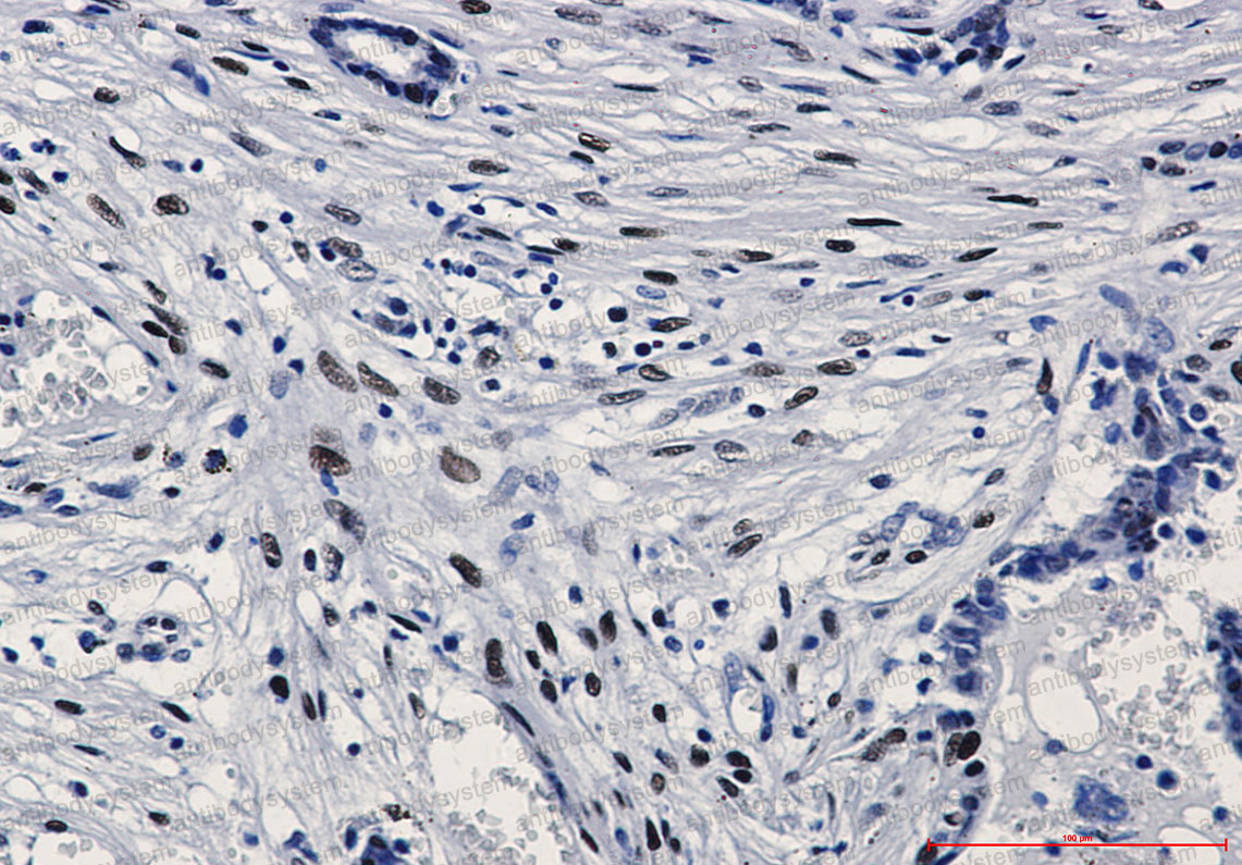 Anti-Phospho-c-Jun (Ser63) Antibody (R1K26)