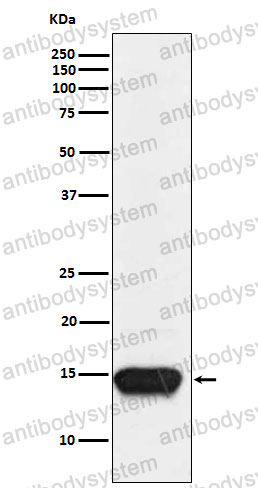Anti-FABP3 Antibody (R1K29)