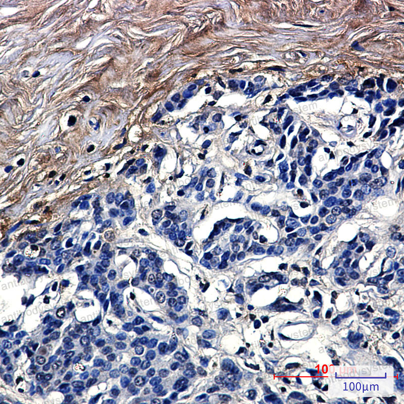 Anti-CLEC3B Antibody (R1K31)