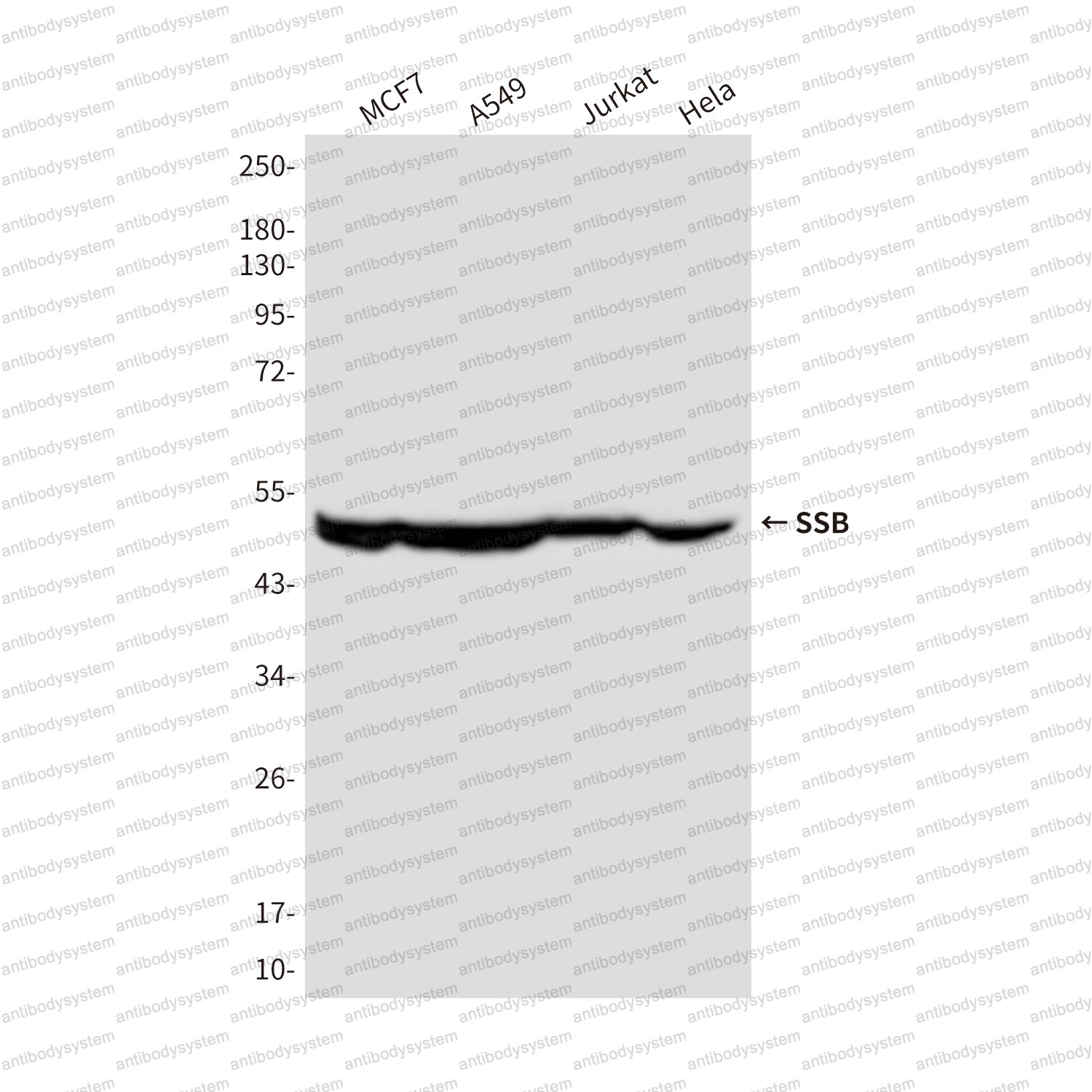 Western blot for Anti-SSB Antibody (R2Z29) ?>