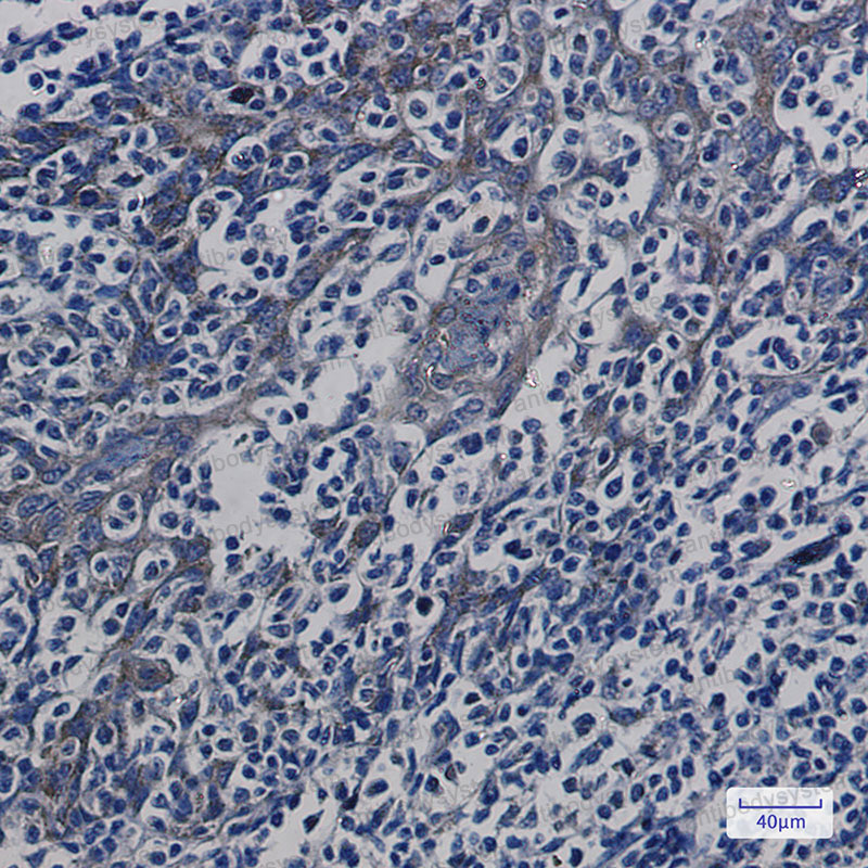Anti-ATP5MC1 Antibody (R1K35)