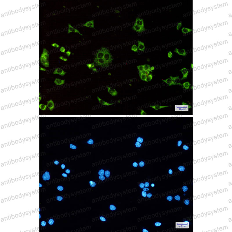 Anti-ATP5MC1 Antibody (R1K34)