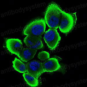 Immunofluorescence for Anti-TBG/SERPINA7 Antibody (R2Z30) ?>
