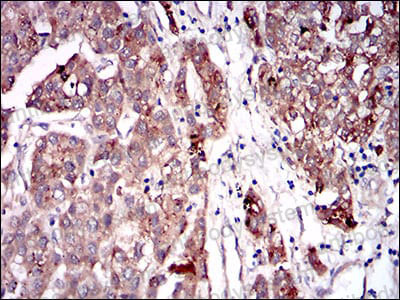 Immunohistochemical for Anti-TBG/SERPINA7 Antibody (R2Z30) ?>