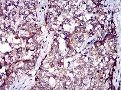 Immunohistochemical for Anti-TBG/SERPINA7 Antibody (R2Z30) ?>