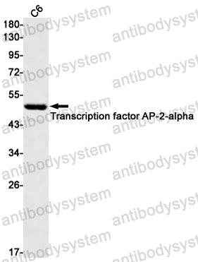 Anti-TFAP2A Antibody (R1K36)