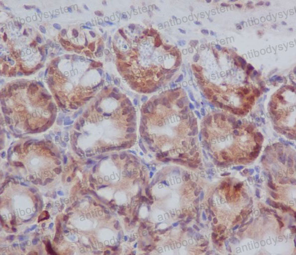 Anti-PRKCB Antibody (R1K38)
