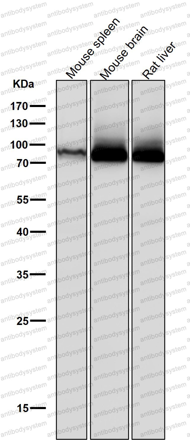 Anti-PRKCB Antibody (R1K39)