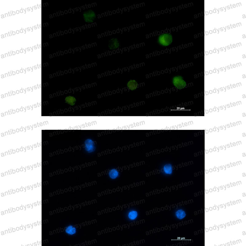 Anti-PRKCB/PKC beta 1 Antibody (R1K40)