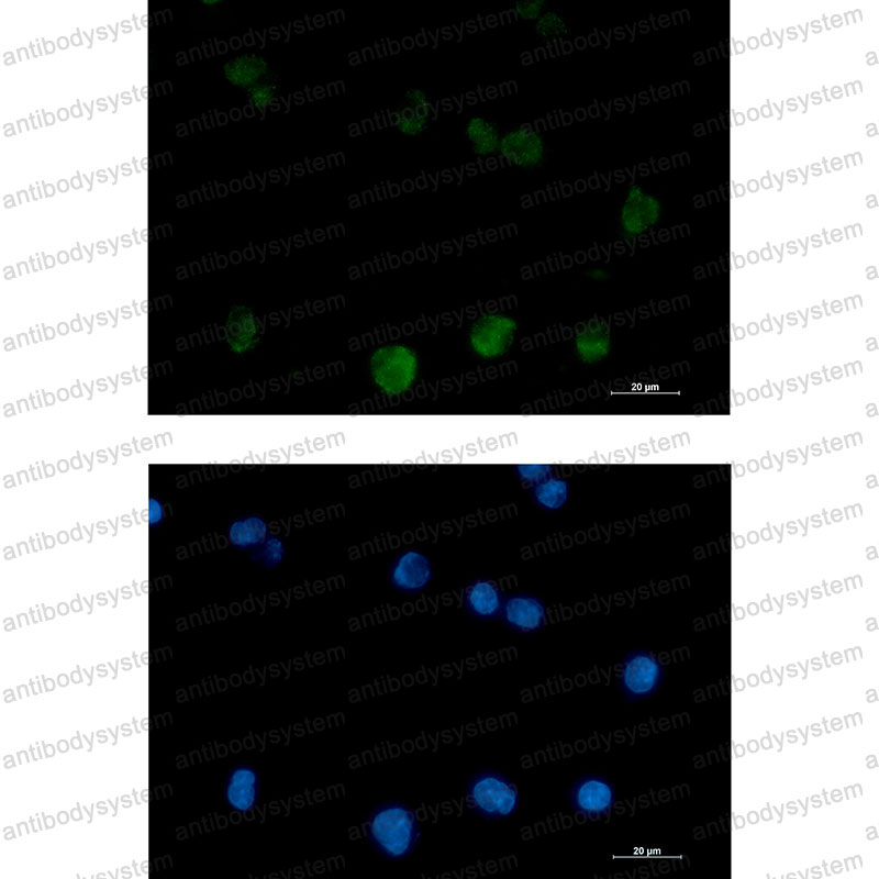 Anti-PRKCB Antibody (R1K41)
