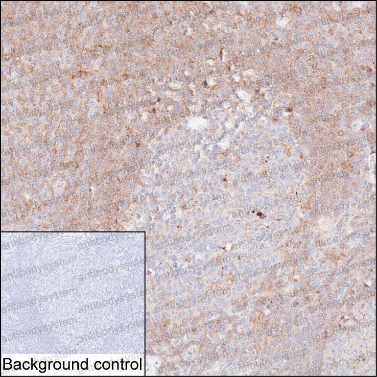 Immunohistochemical for Anti-PRKCB Antibody (R2Z39) ?>
