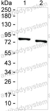 Western blot for Anti-PRKCB Antibody (R2Z39) ?>