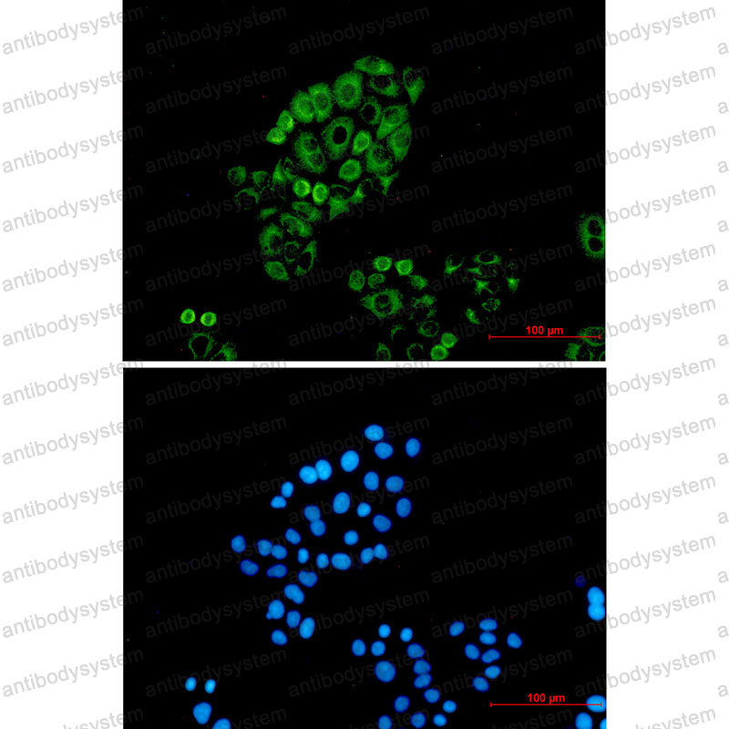 Anti-KRT18 Antibody (R1K42)
