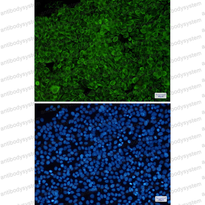 Anti-Phospho-KRT8/CK-8 (Ser23) Antibody (R1K43)
