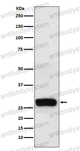 Anti-CSN2 Antibody (R1K44)