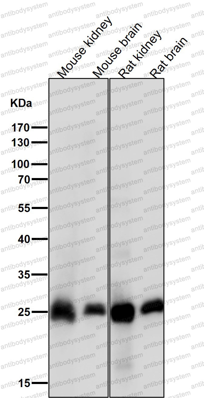 Anti-CALB1 Antibody (R1K45)