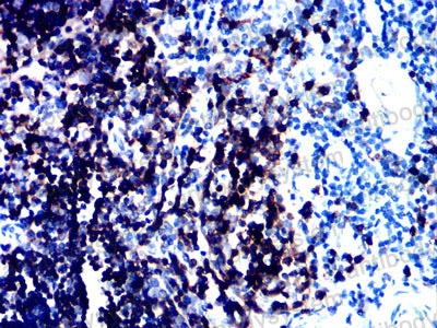Immunohistochemical for Anti-CD1a Antibody (R2Z49) ?>