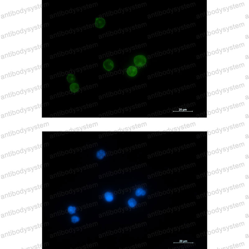 Anti-LCK Antibody (R1K47)