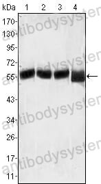 Western blot for Anti-LCK Antibody (R2Z59) ?>