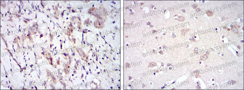 Immunohistochemical for Anti-FYN Antibody (R2Z60) ?>