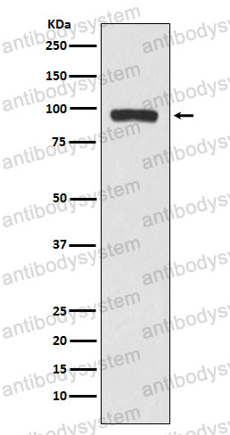 Anti-BCHE/CHE1 Antibody (R1K50)
