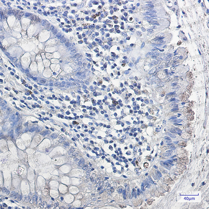 Anti-GLA Antibody (R1K52)