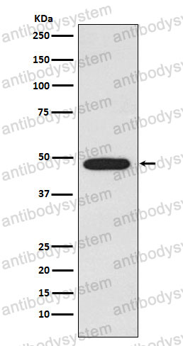 Anti-GLA Antibody (R1K51)