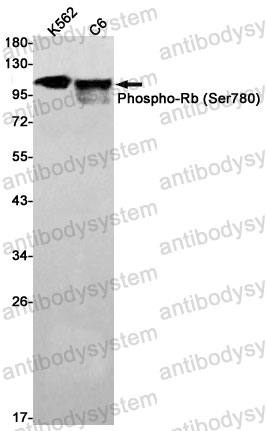 Anti-Phospho-RB1 (Ser780) Antibody (R1K55)