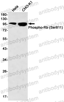 Anti-Phospho-RB1 (Ser811) Antibody (R1K56)