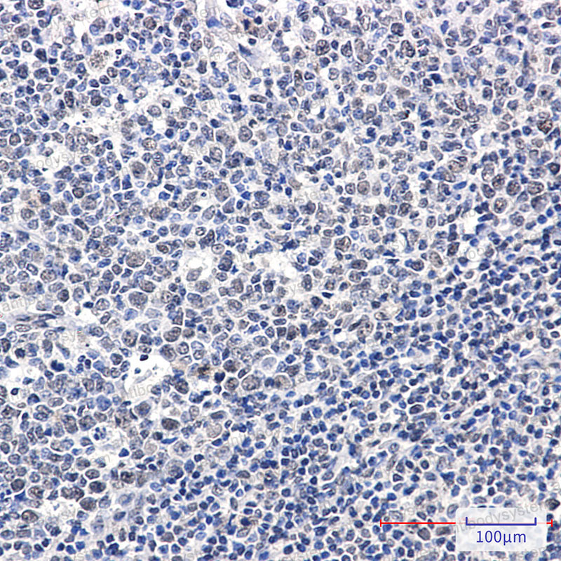 Anti-Phospho-RB1 (Ser608) Antibody (R1K57)