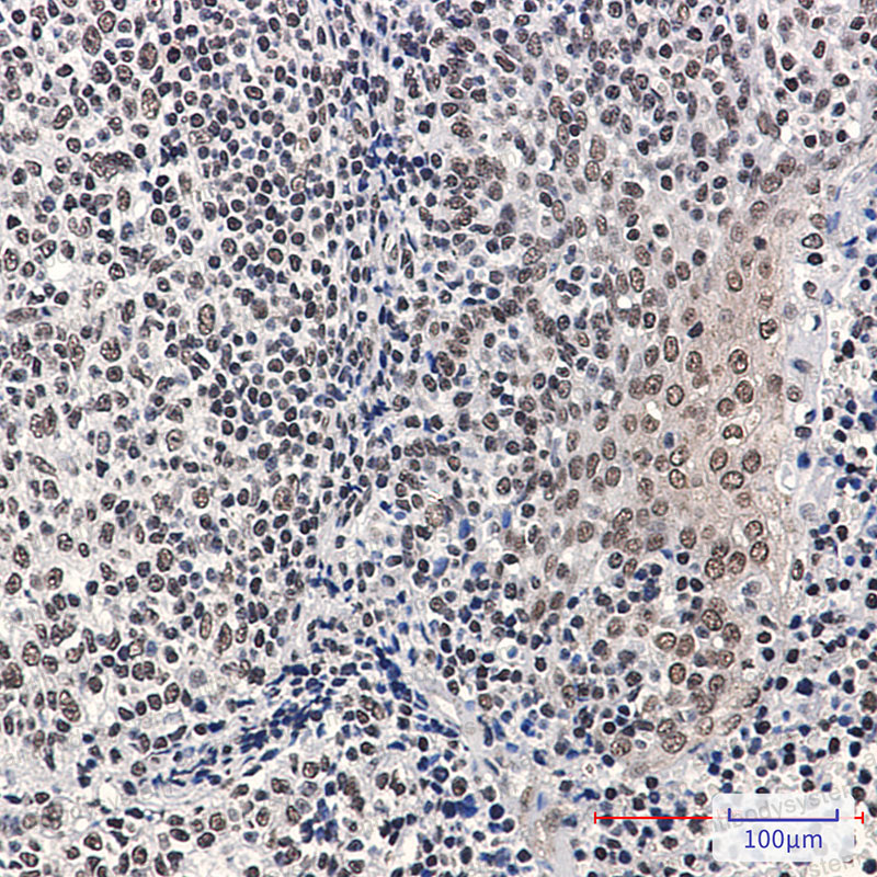 Anti-Phospho-RB1 (Ser780) Antibody (R1K58)