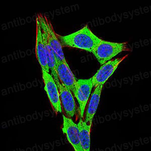 Immunofluorescence for Anti-RB1 Antibody (R2Z64) ?>
