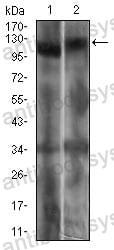 Western blot for Anti-RB1 Antibody (R2Z64) ?>