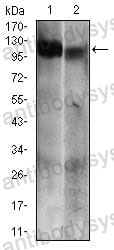Western blot for Anti-RB1 Antibody (R2Z65) ?>