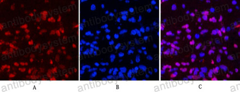 Immunofluorescence for Anti-PGR Antibody (R2Z69) ?>