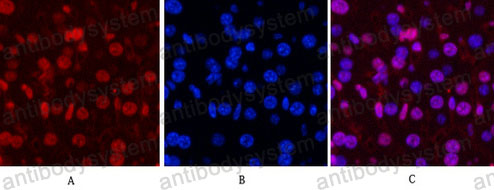 Immunofluorescence for Anti-PGR Antibody (R2Z69) ?>