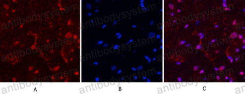 Immunofluorescence for Anti-PGR Antibody (R2Z69) ?>
