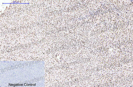 Immunohistochemical for Anti-PGR Antibody (R2Z69) ?>