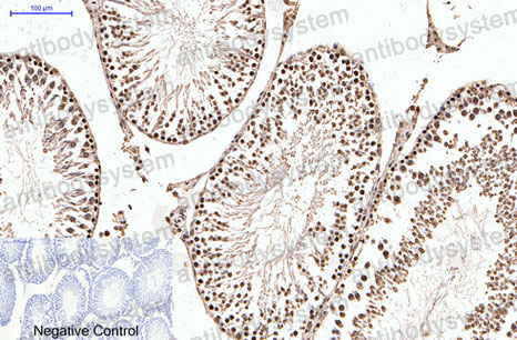 Immunohistochemical for Anti-PGR Antibody (R2Z69) ?>