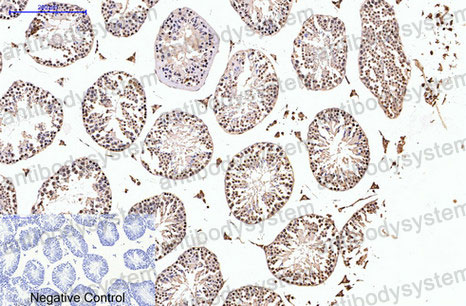 Immunohistochemical for Anti-PGR Antibody (R2Z69) ?>
