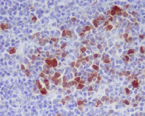 Anti-Phospho-CDK1/2 (T14) Antibody (R1C14)