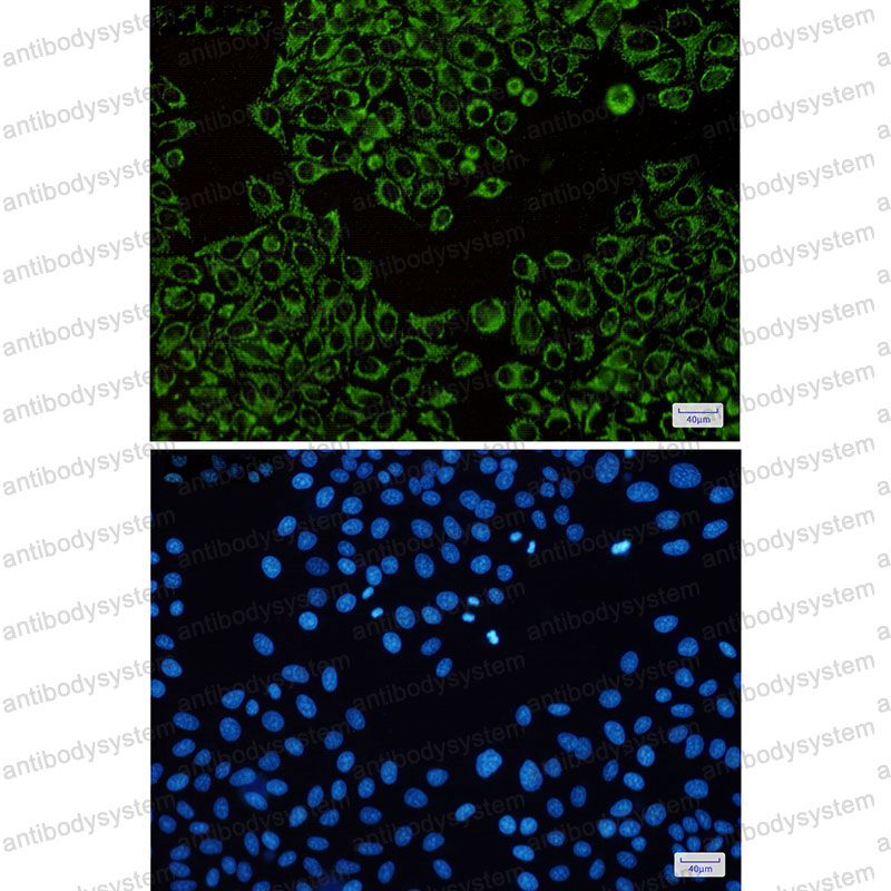 Anti-ATP5F1B Antibody (R1K69)