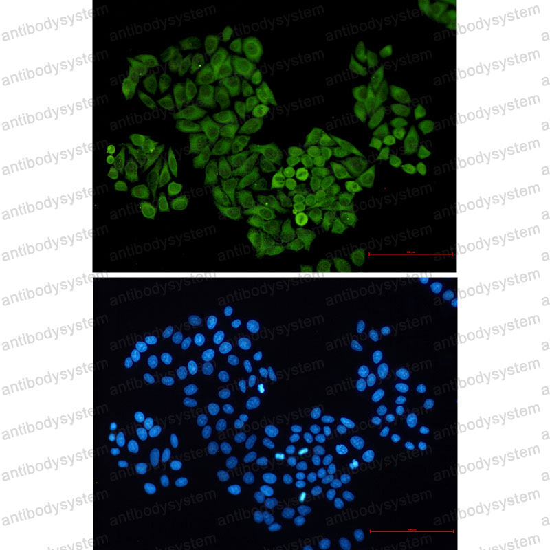 Anti-S100A6 Antibody (R1K71)